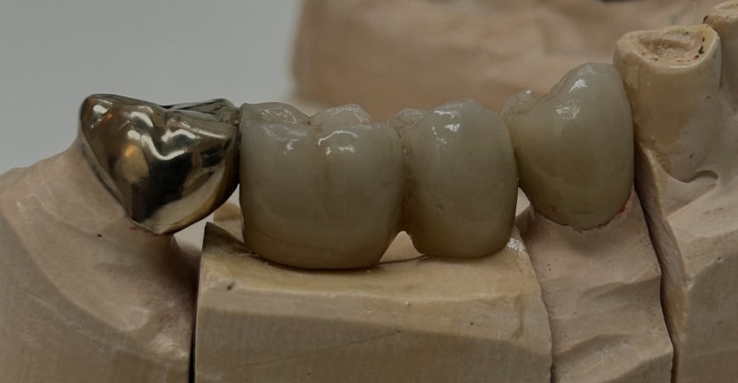 Treatments - Campden House Dental