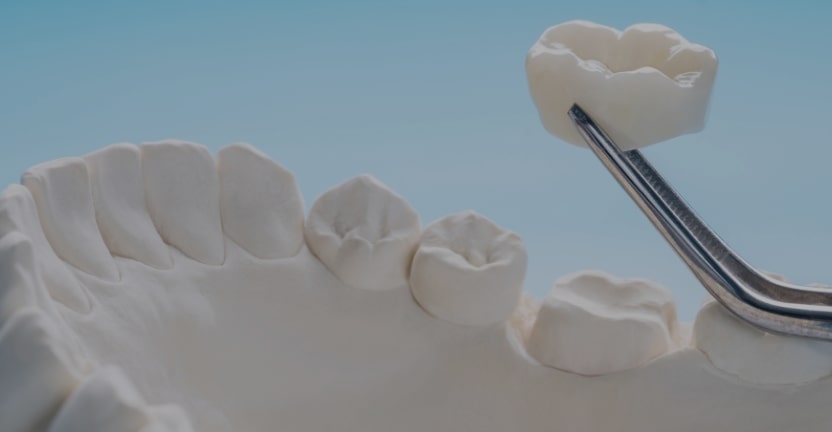 Treatments - Campden House Dental