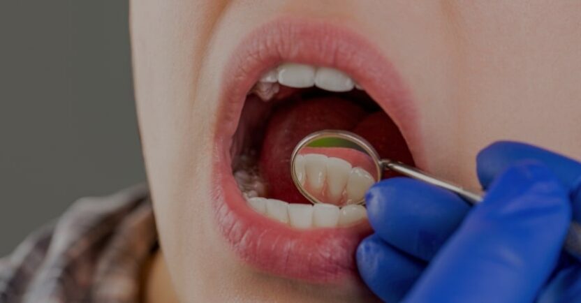 Treatments - Campden House Dental