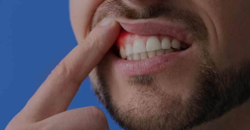 Treatments - Campden House Dental